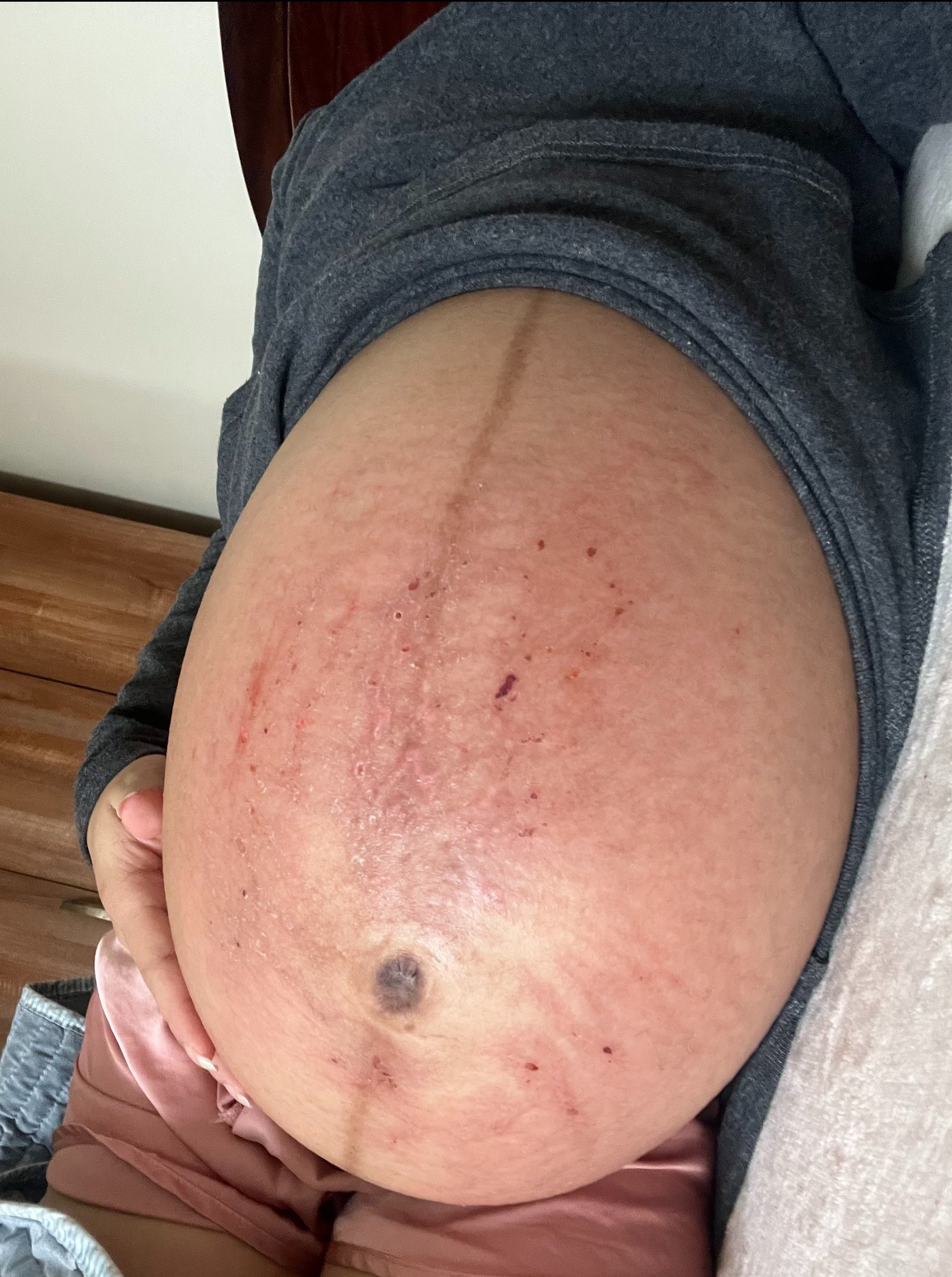 Tưởng bị u nang khó có con, ai ngờ đi siêu âm bác sĩ báo tam thai, mẹ 9X lo nhiều hơn mừng - 3